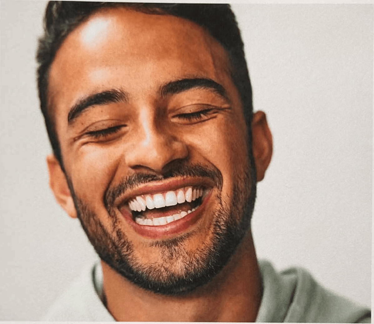 Free Dental Care for UE Amsterdam Students